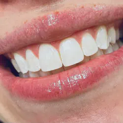 /img/29207-healthy-smile.webp