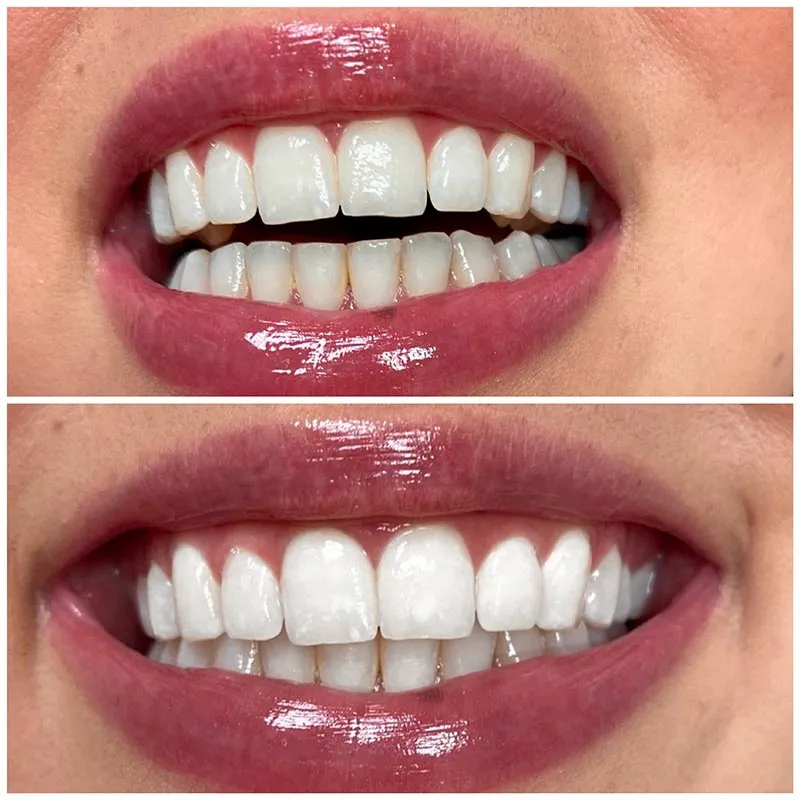 29207 whitening toothpaste