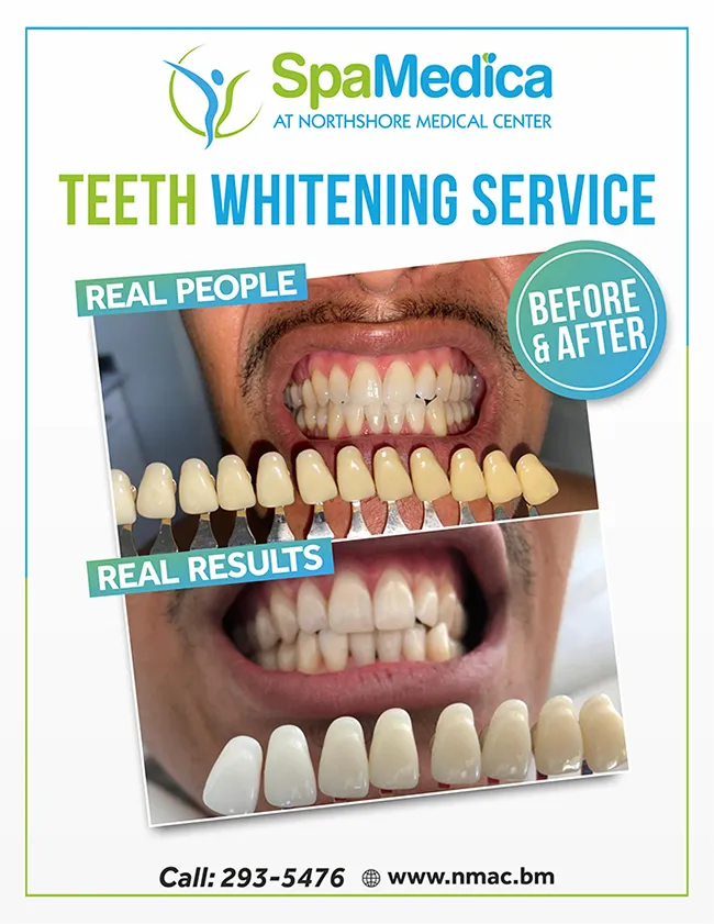 29209 dental hygiene teeth cleaning