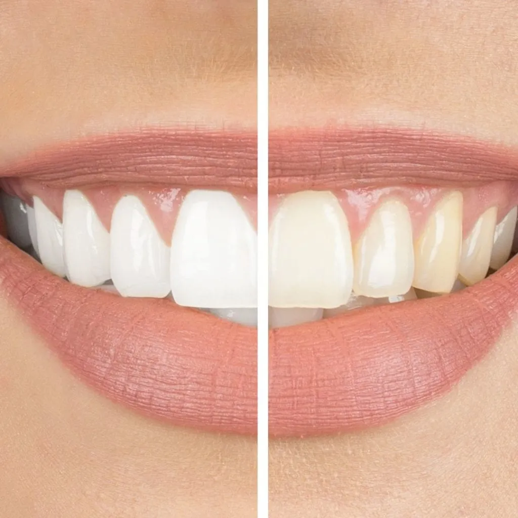 /img/29209-teeth-whitening-foods-drinks.webp
