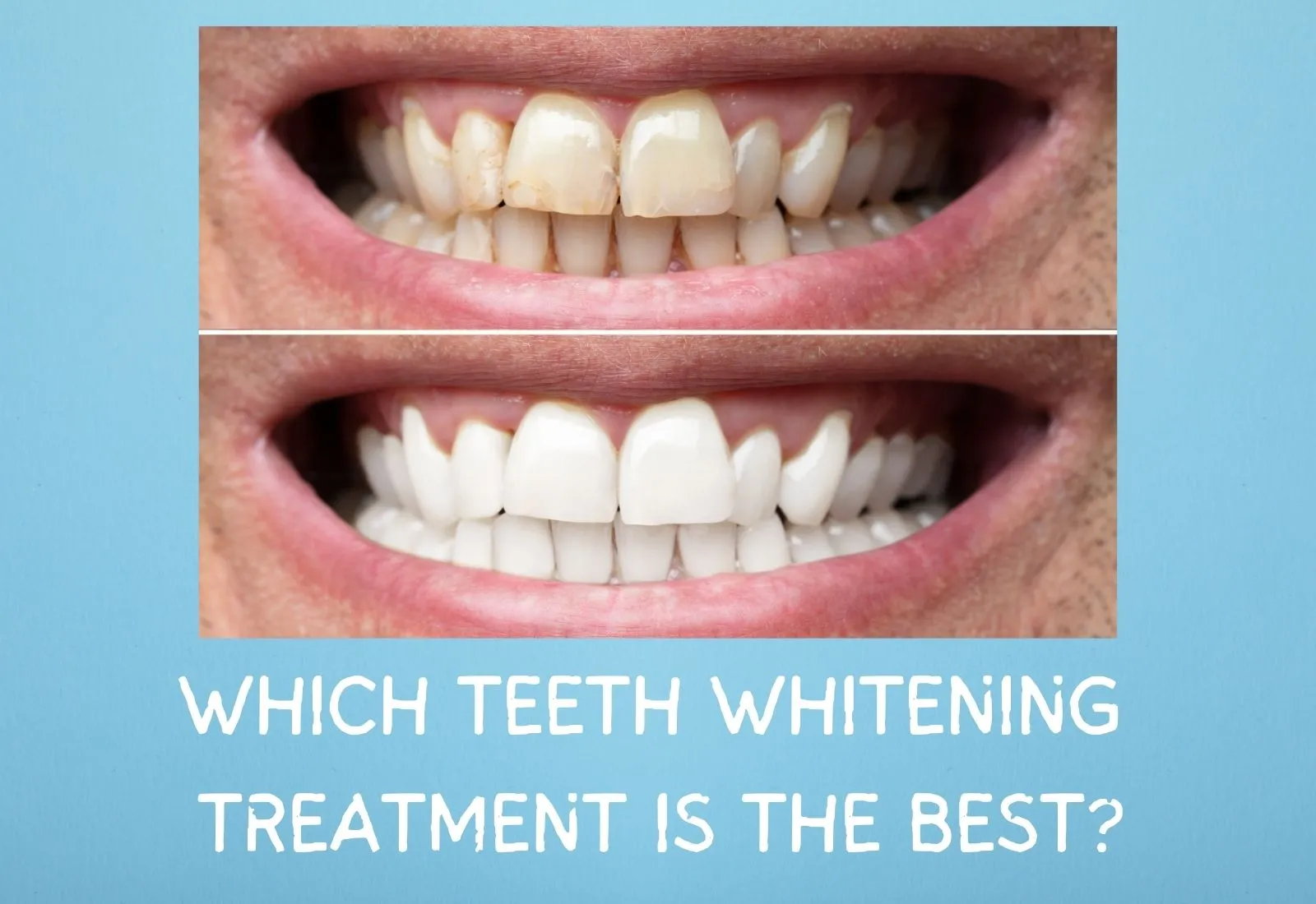 /img/29211-dental-checkup.webp
