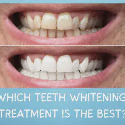 /img/29211-dental-checkup.webp