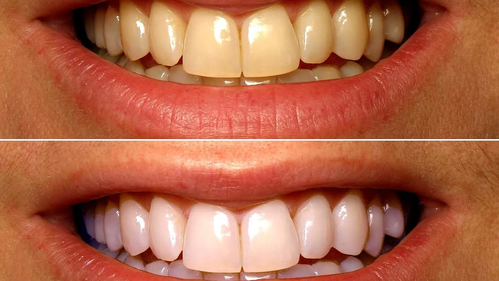 29211 science of teeth whitening