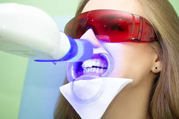 29213 laser teeth whitening pittsburgh maintenance