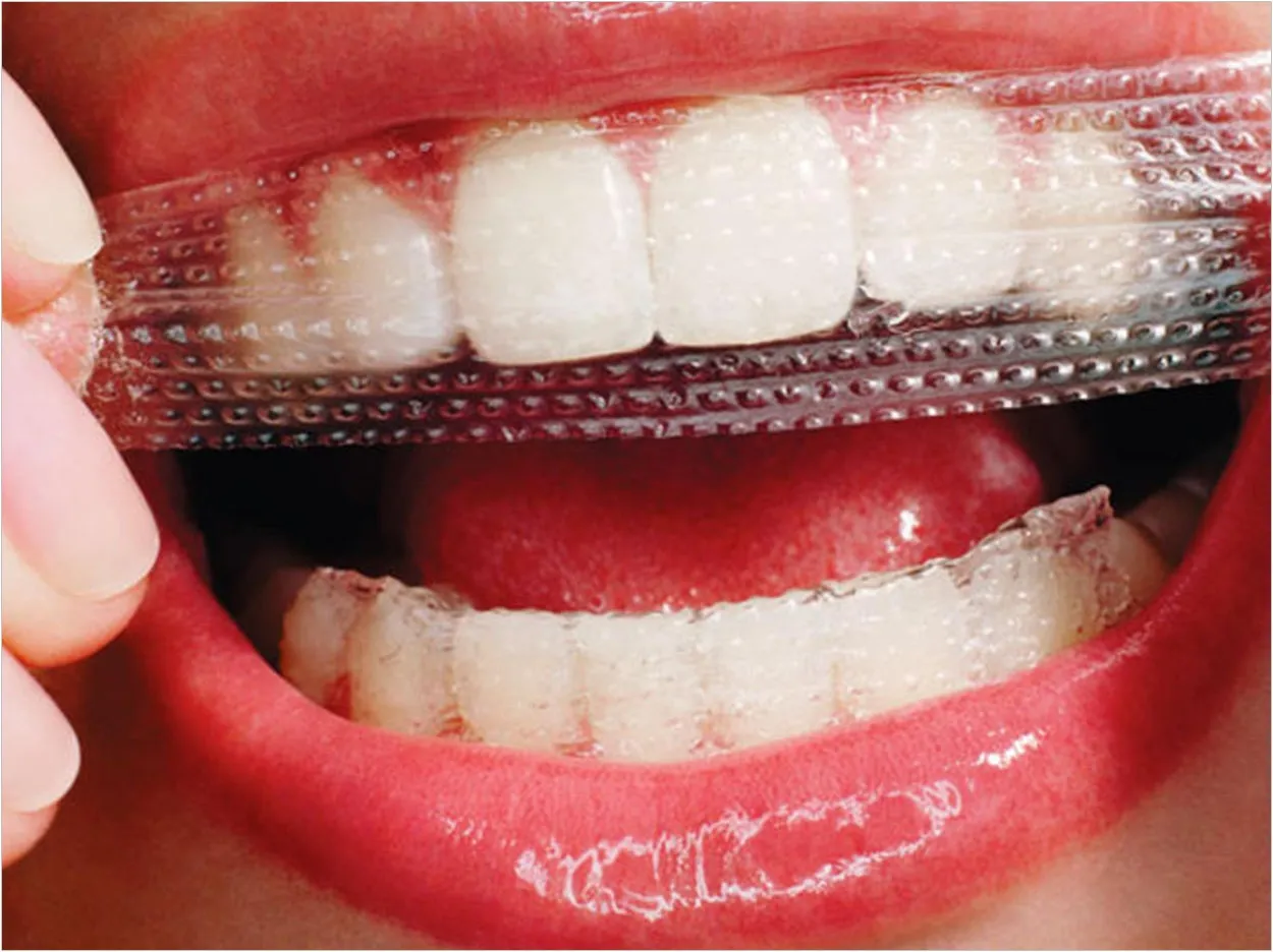 29215 whitening strips damage teeth image2