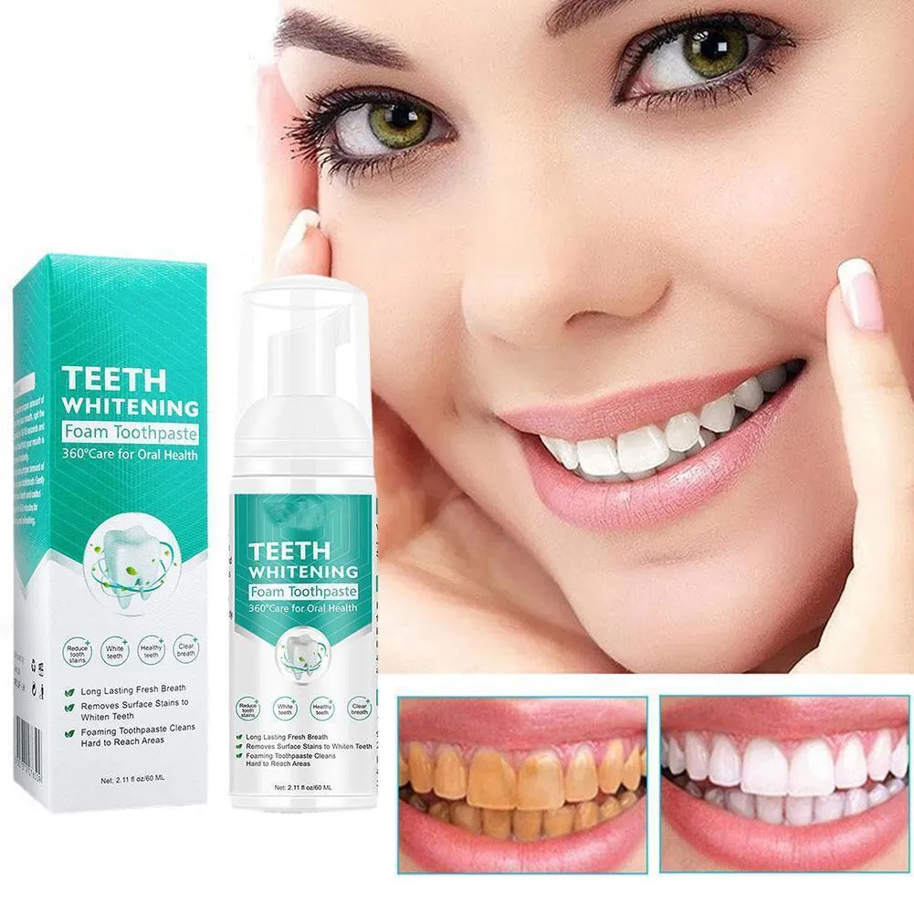 29216 professional teeth whitening