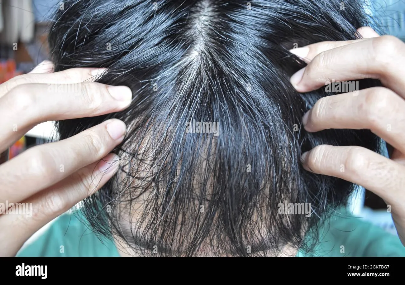 29217 premature hair whitening diet
