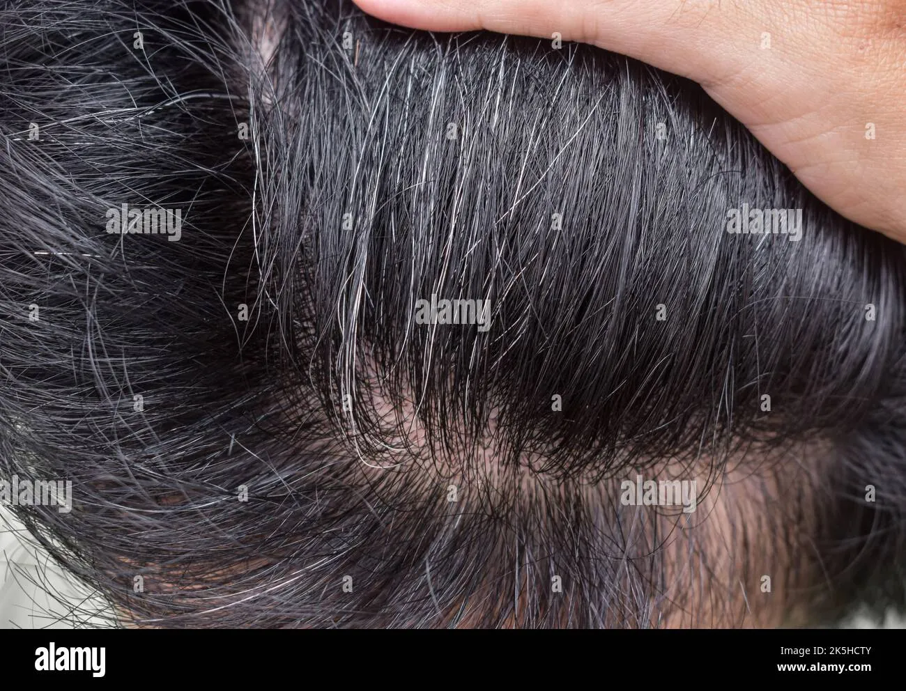 /img/29217-premature-hair-whitening-doctor.webp