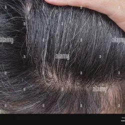 /img/29217-premature-hair-whitening-doctor.webp