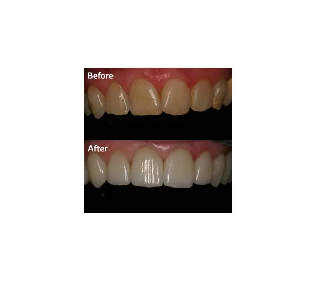 29218 avoiding staining foods
