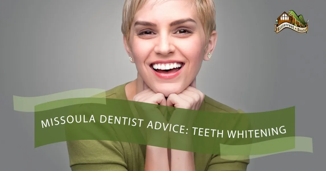 29221 at home teeth whitening kit