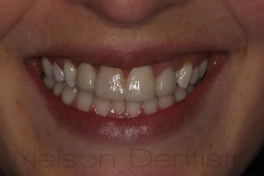 29221 healthy teeth and gums