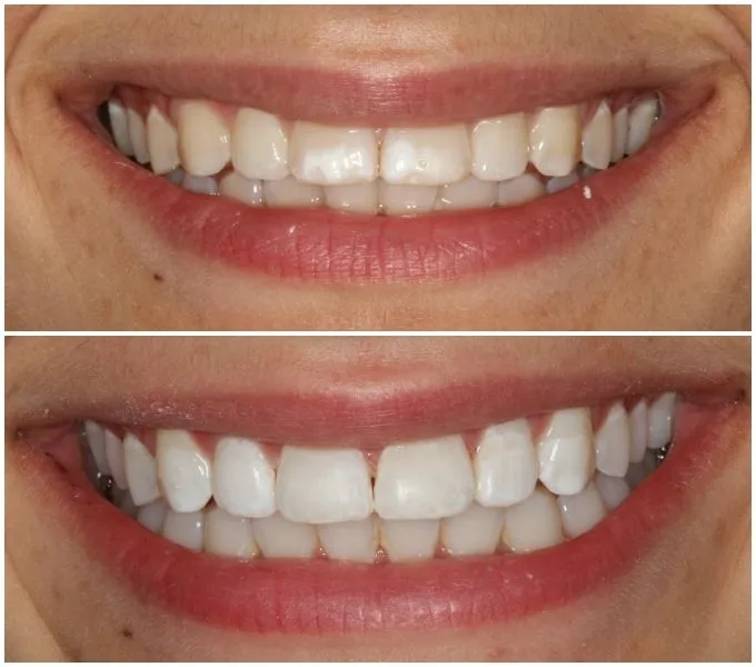 29221 missoula dentist consultation