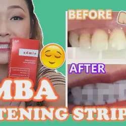 /img/29224-teeth-whitening-sensitivity.webp