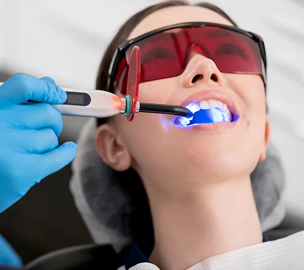 29232 teeth whitening houston 3