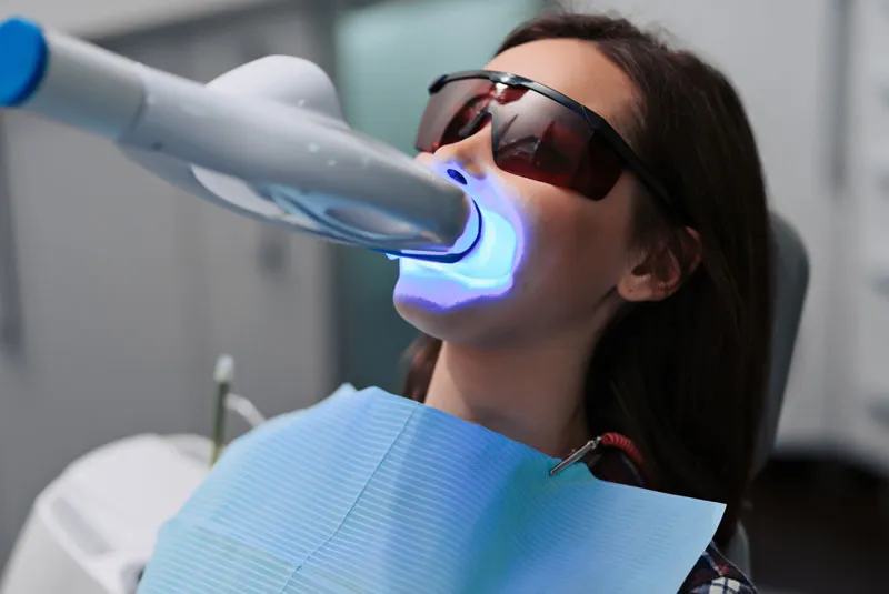 /img/29232-teeth-whitening-houston-7.webp