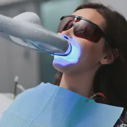 /img/29232-teeth-whitening-houston-7.webp