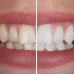 /img/29234-dental-checkups.webp