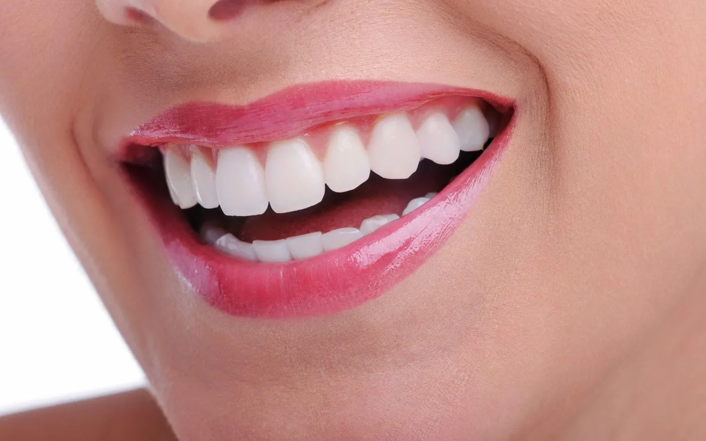 29234 teeth whitening strips