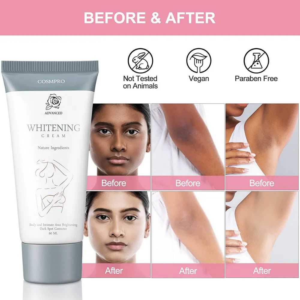 29236 whitening lotion skin tone