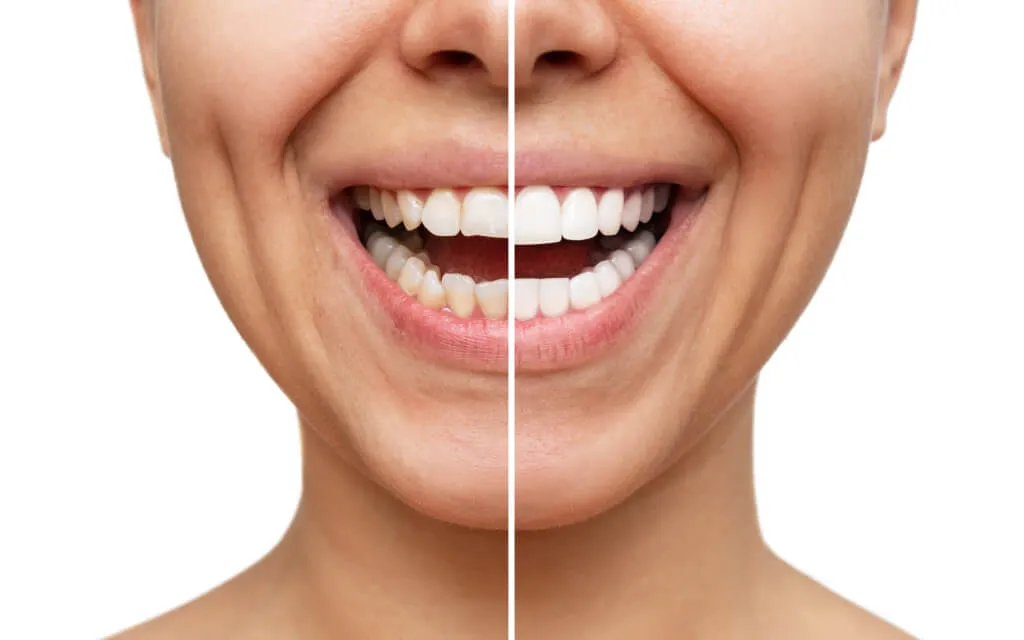 /img/29238-healthy-diet-teeth.webp