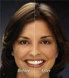 29238 oral hygiene tips