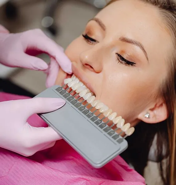 29238 professional teeth whitening