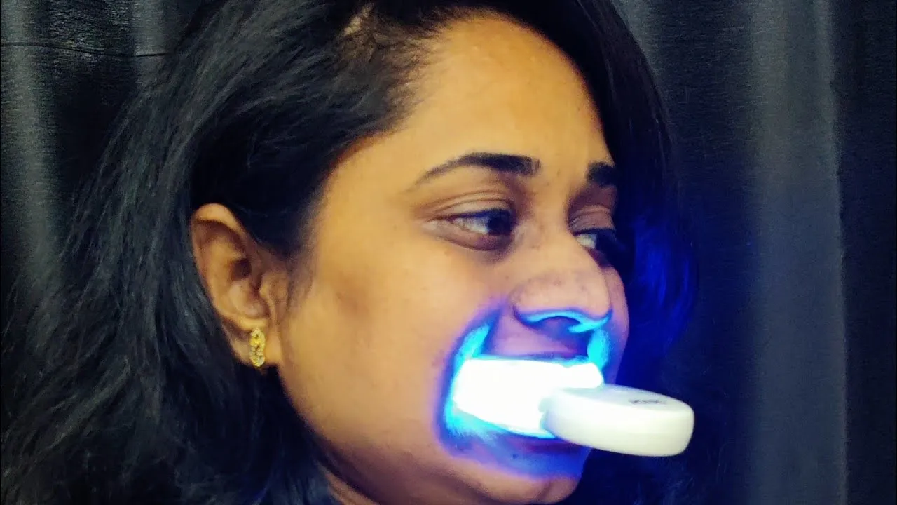 29239 teeth sensitivity