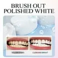 29239 teeth whitening process