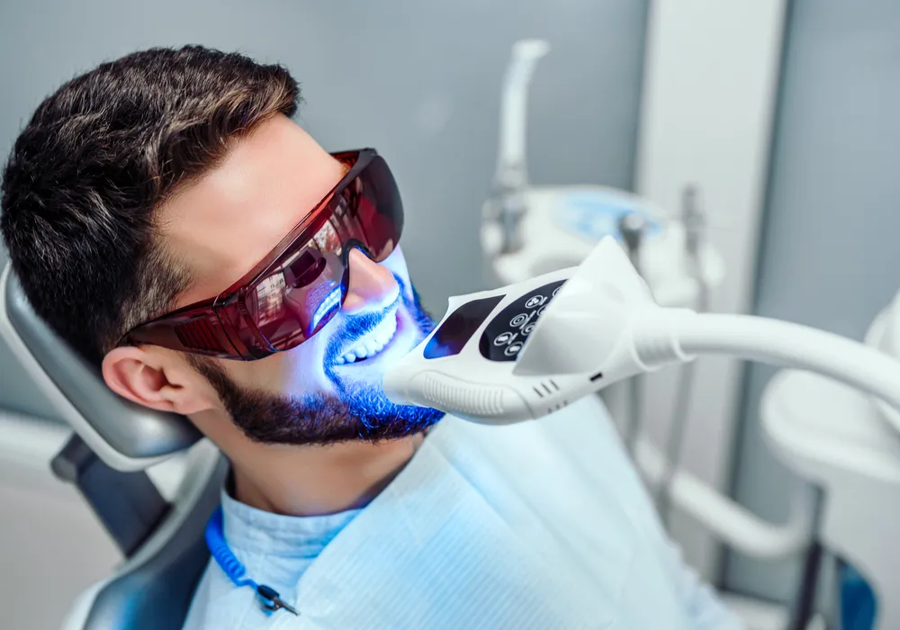 29240 professional teeth whitening