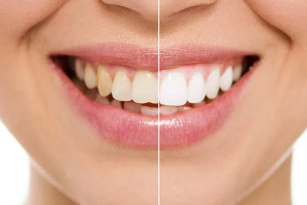 /img/29240-st-louis-dentist.webp