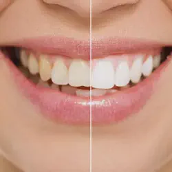 /img/29240-st-louis-dentist.webp