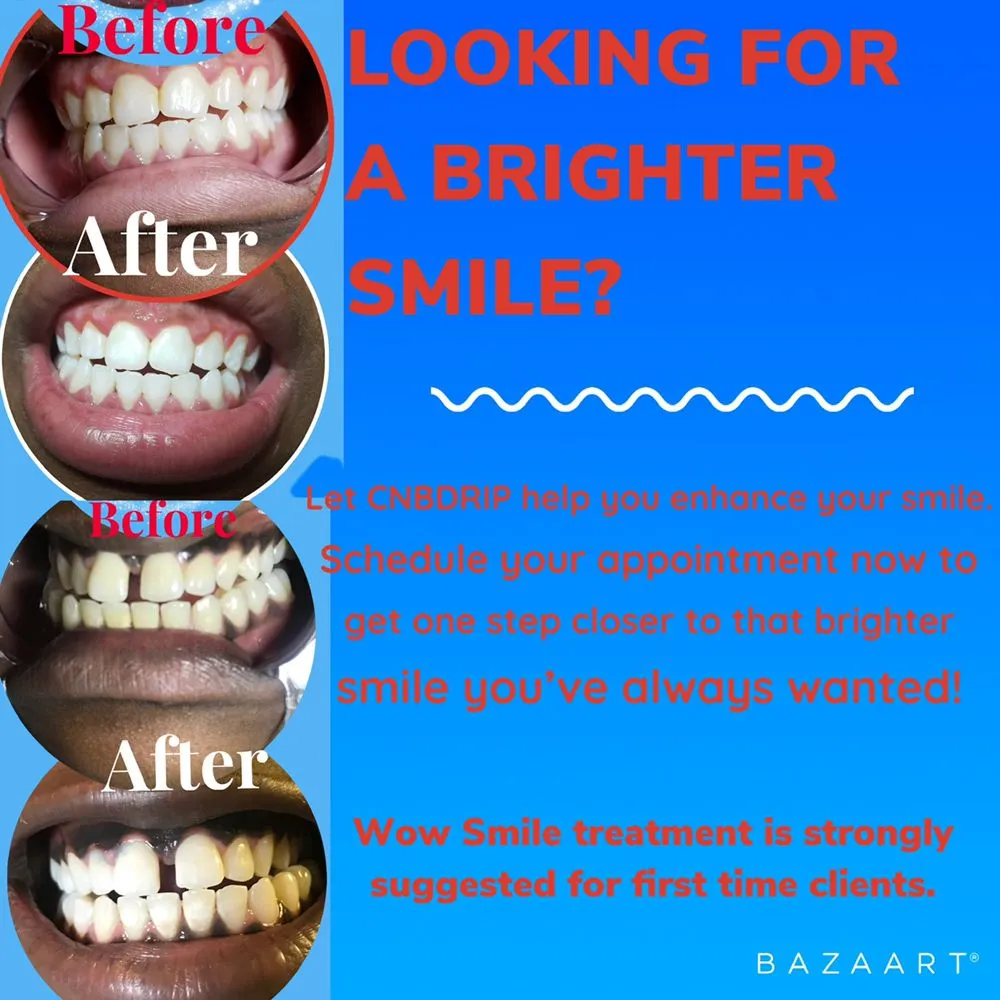 29240 take home teeth whitening