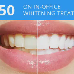 /img/29243-teeth-whitening-office-price-7.webp