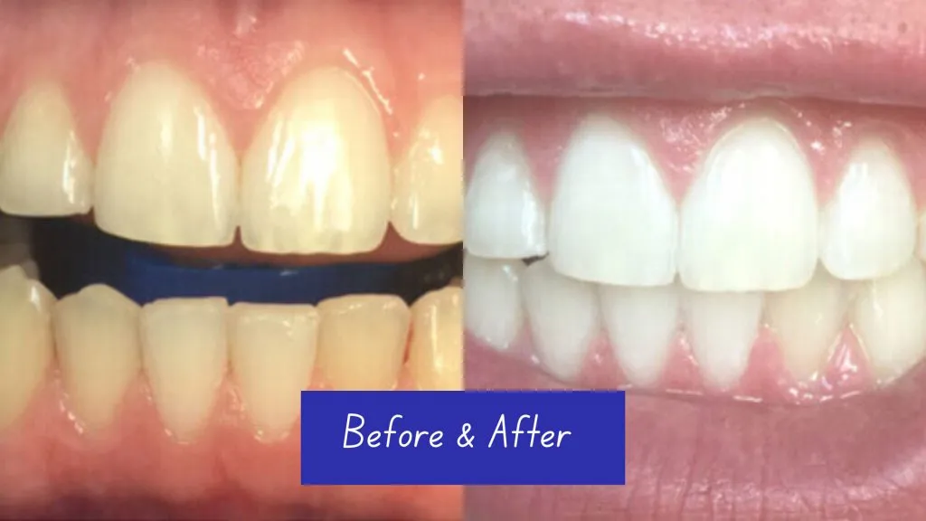 29244 boosted oral health