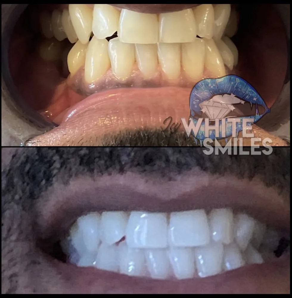 /img/29244-teeth-whitening-results.webp