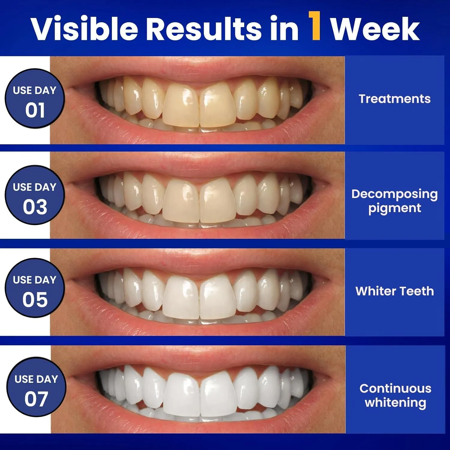 29250 at home teeth whitening