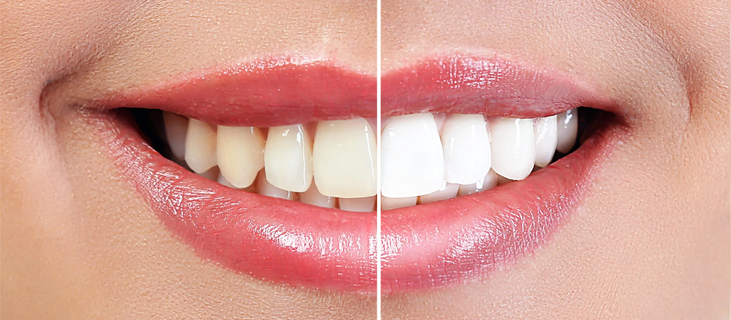 29252 dental conditions