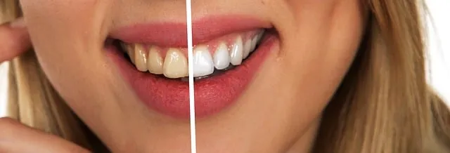 29252 dentist visit
