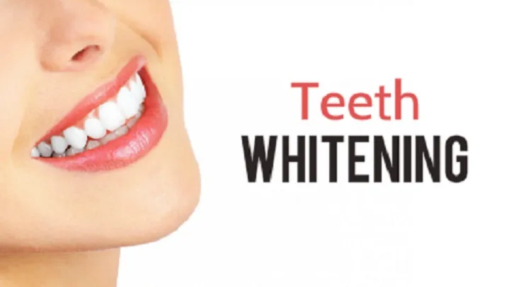/img/29252-maintaining-white-teeth.webp