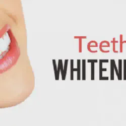 /img/29252-maintaining-white-teeth.webp