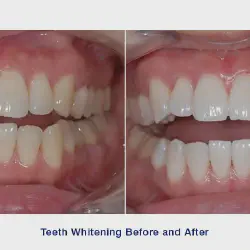 /img/29253-dental-checkup-johannesburg.webp