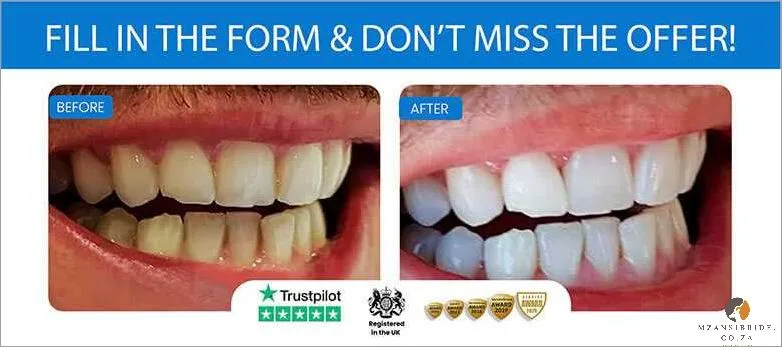 29253 in office teeth whitening johannesburg
