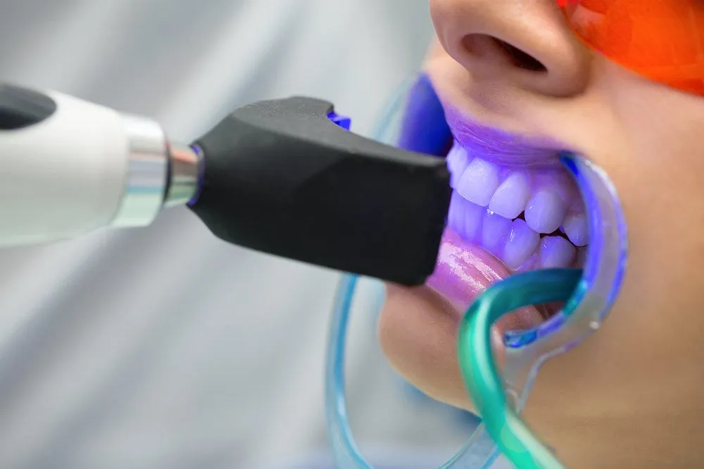 29255 teeth whitening maintenance