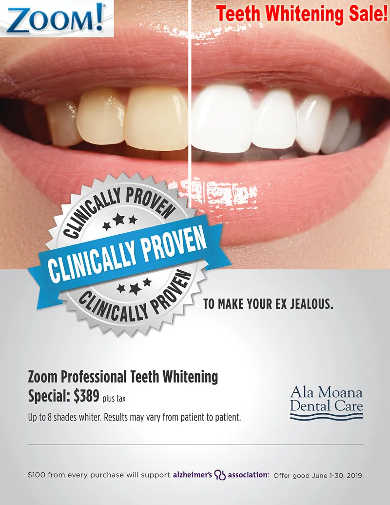 /img/29256-spotlight-teeth-whitening-checkout.webp