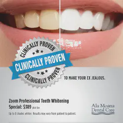 /img/29256-spotlight-teeth-whitening-checkout.webp