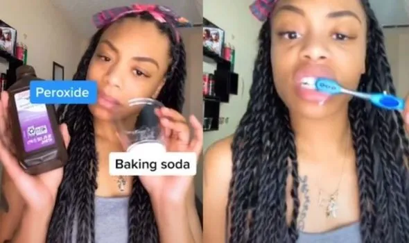 29262 brushing teeth whitening