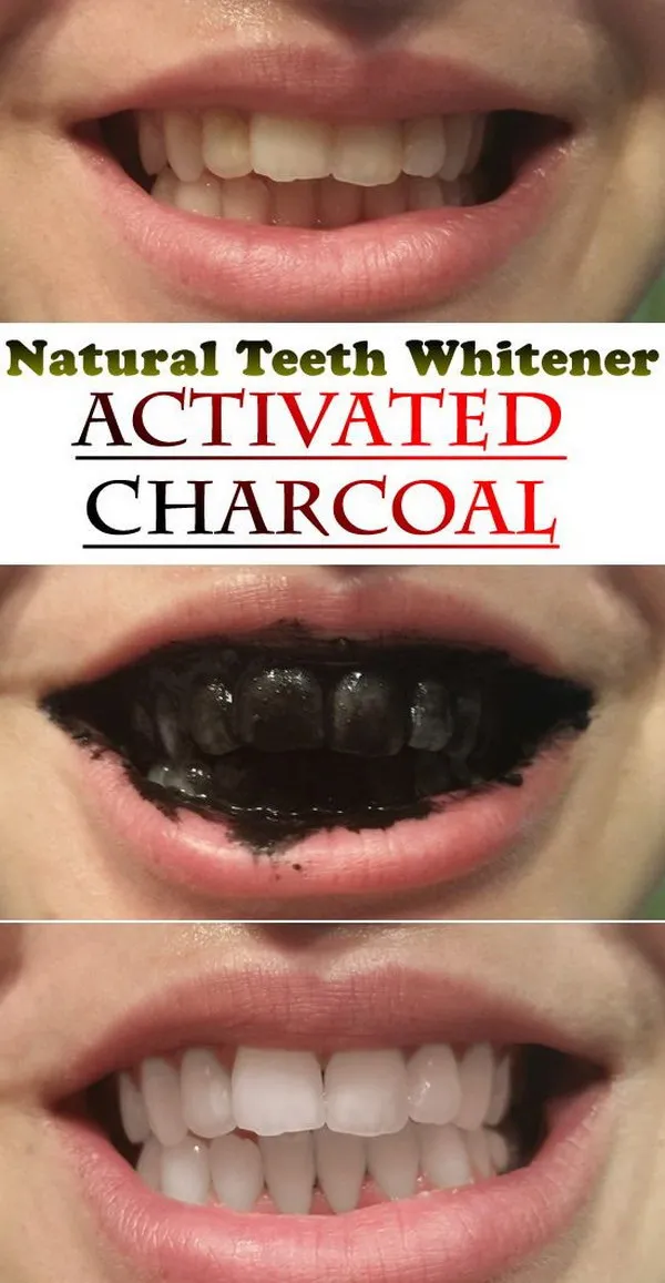 29265 apple cider vinegar rinse