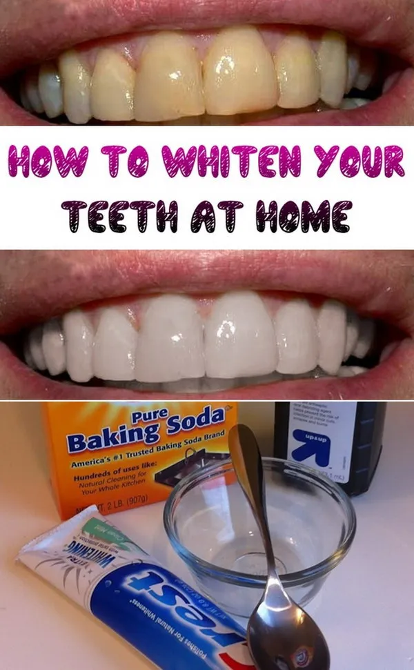 29265 baking soda hydrogen peroxide