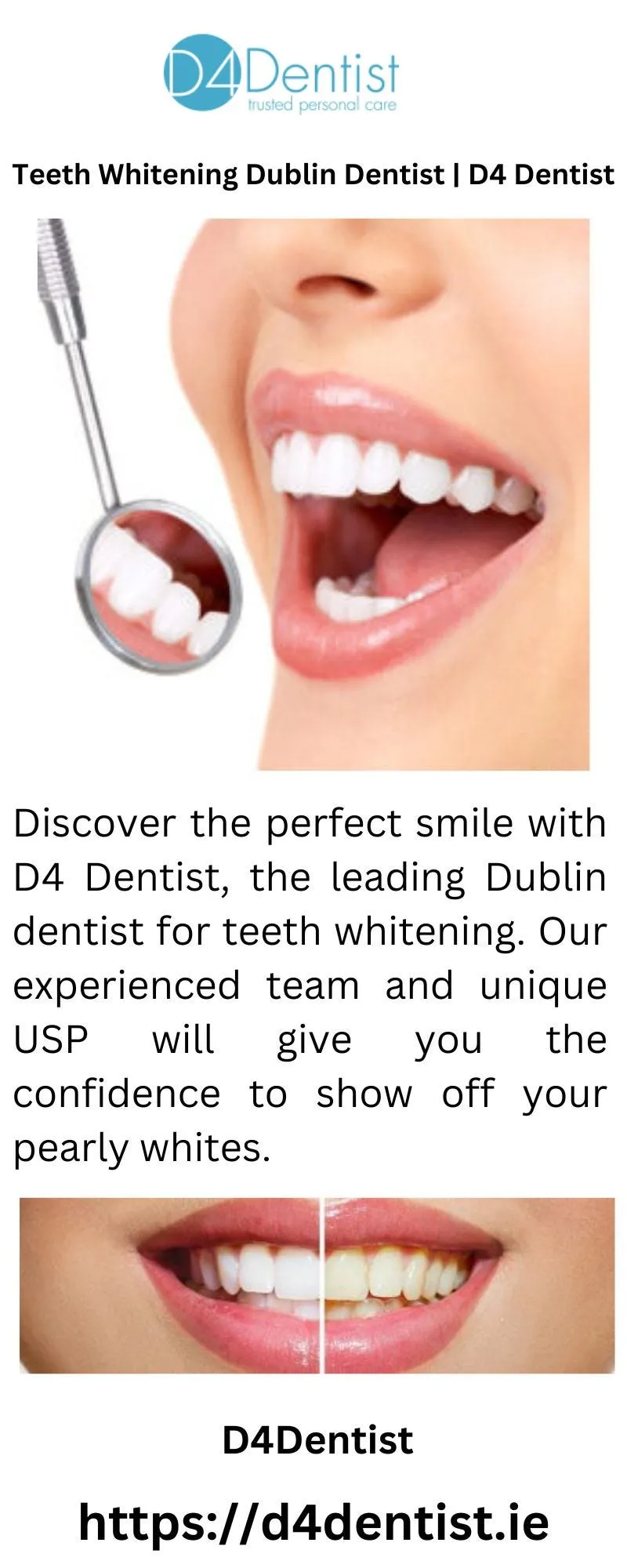 29266 sensitive teeth whitening